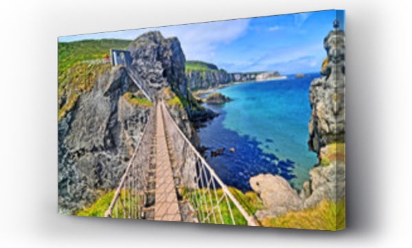 Wizualizacja Obrazu : #285538995 Carrick-a-Rede Rope Bridge  - rope bridge in , Northern Ireland.