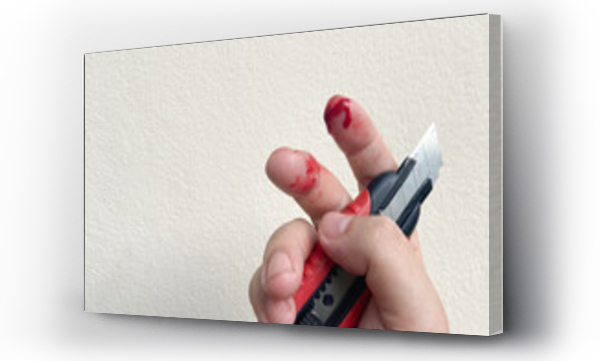 Wizualizacja Obrazu : #546580182 There is a red bloody wound on the finger, an accidental knife or cutter cut on the finger of a man or a woman.